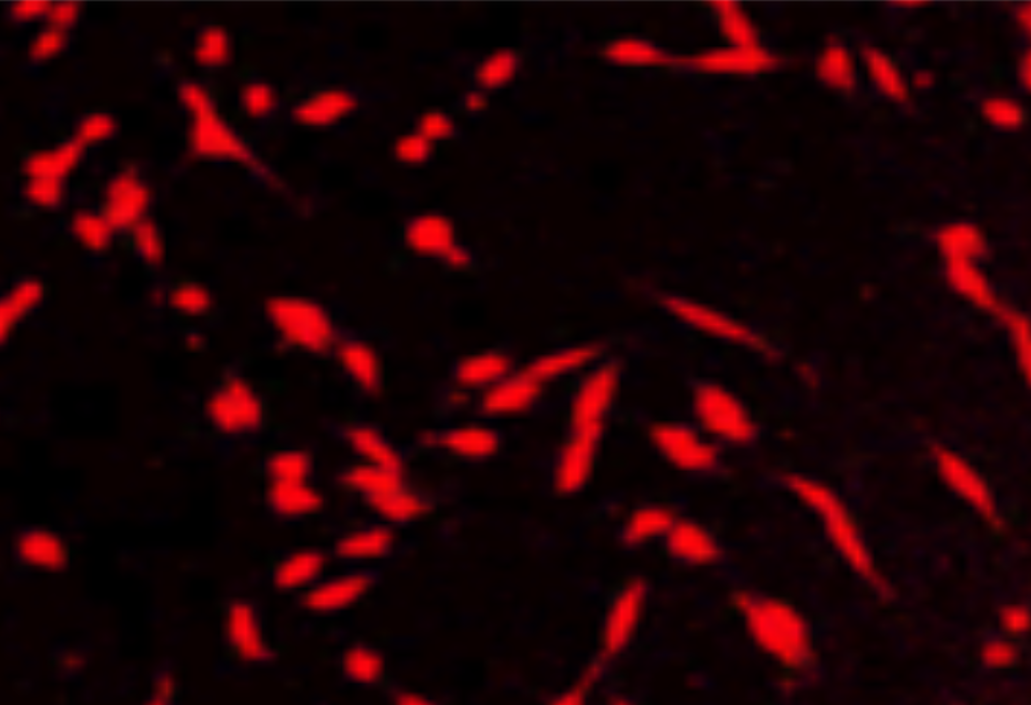 Microscope imaging showing high CQDs uptake in cancer cells
